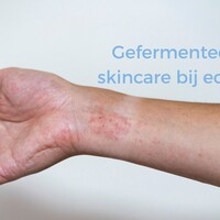 Kan gefermenteerde skincare helpen bij eczeem? De wetenschap achter postbiotica en een gezonde huidbarrière