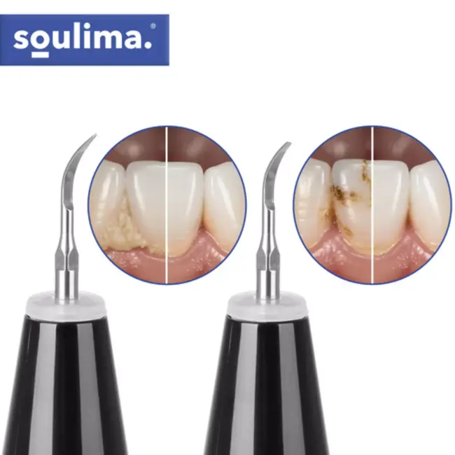 Soulima Ultrasone tandreiniger met 5 intensiteiten, LED verlichting en tips voor tandsteen verwijderen