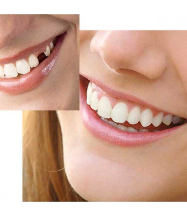 GrillzShop Tand afgebroken reparatie kit InstantSmile gebit (goedkope kunstgebit) - Theeth Recovery -  Multishade