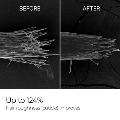 Bondex Protein Bonding Remodeling Clinic