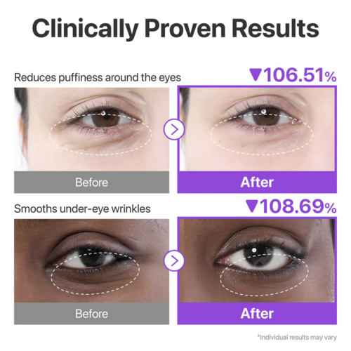 Numbuzin  No.9 NAD+ Collagen Under Eye Patches