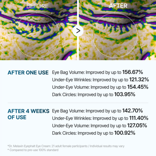 Dr.Melaxin Eyephalt Eyebag Cream Dr.Melaxin Eyephalt Eyebag Cream