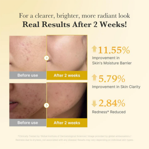 Medicube Kojic Acid Turmeric Niacinamide Serum Medicube Kojic Acid Turmeric Niacinamide Serum