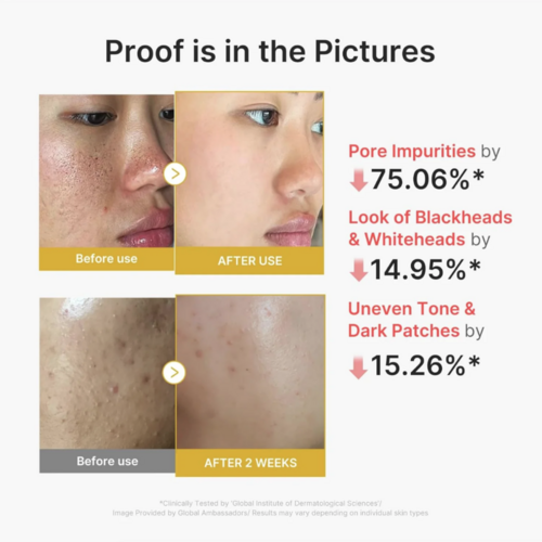 Medicube Kojic Acid Turmeric Peel Shot