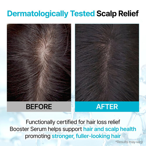Growus Recover Therapy Hair Booster Serum Growus Recover Therapy Hair Booster Serum