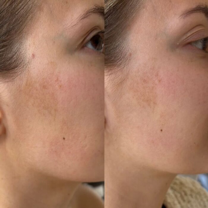 Ray Anti-pigmentvlekken serum 30ml - Ray