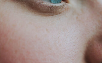 Grove poriën? Deze ingrediënten helpen!