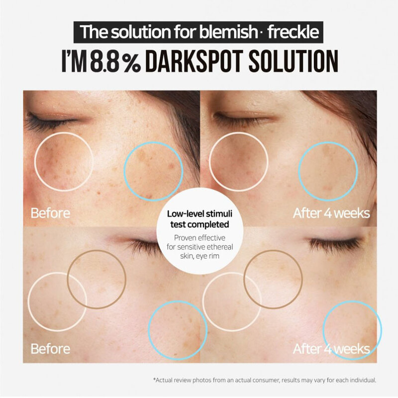 I'm 8.8% Dark Spot Solution