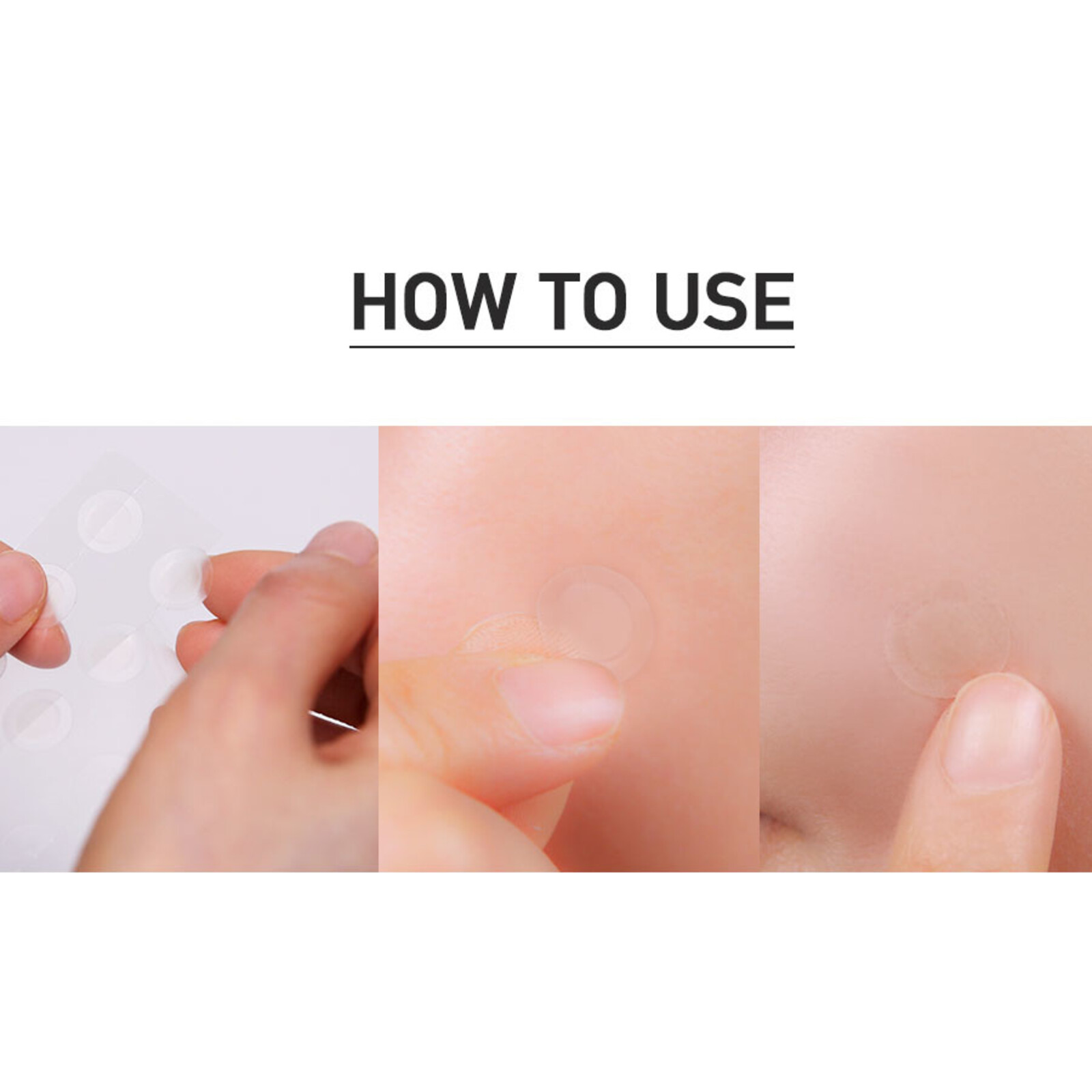 Neogen A-clear Soothing Spot Patch 24 Count (1 Pack)