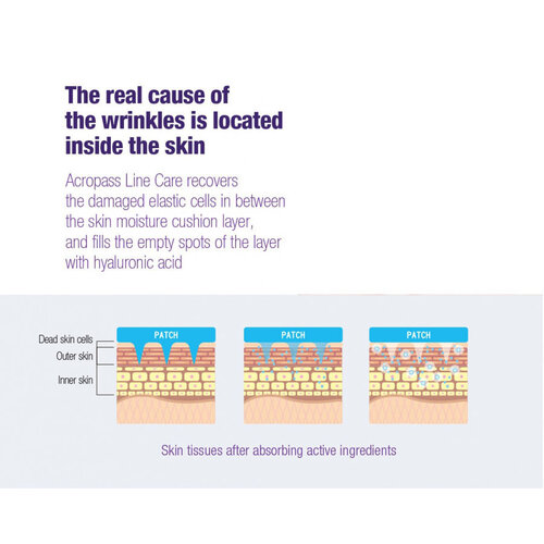 Line Care Patch (4 patches) AcroPass Line Care Patch (4 patches)