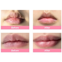 Honey Glow Lip Mask By Ecom Honey Glow Lip Mask