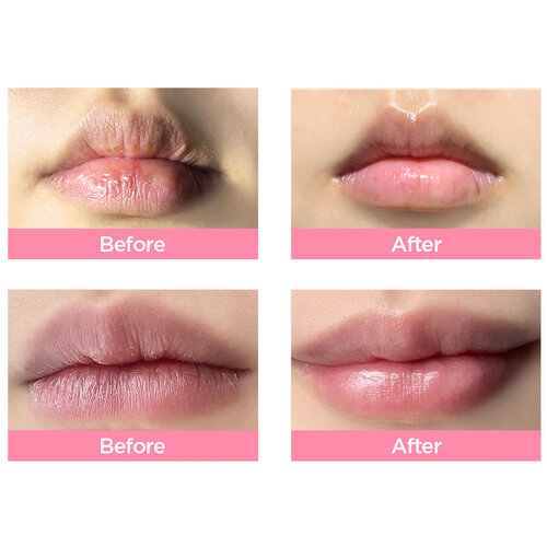 Honey Glow Lip Mask By Ecom Honey Glow Lip Mask