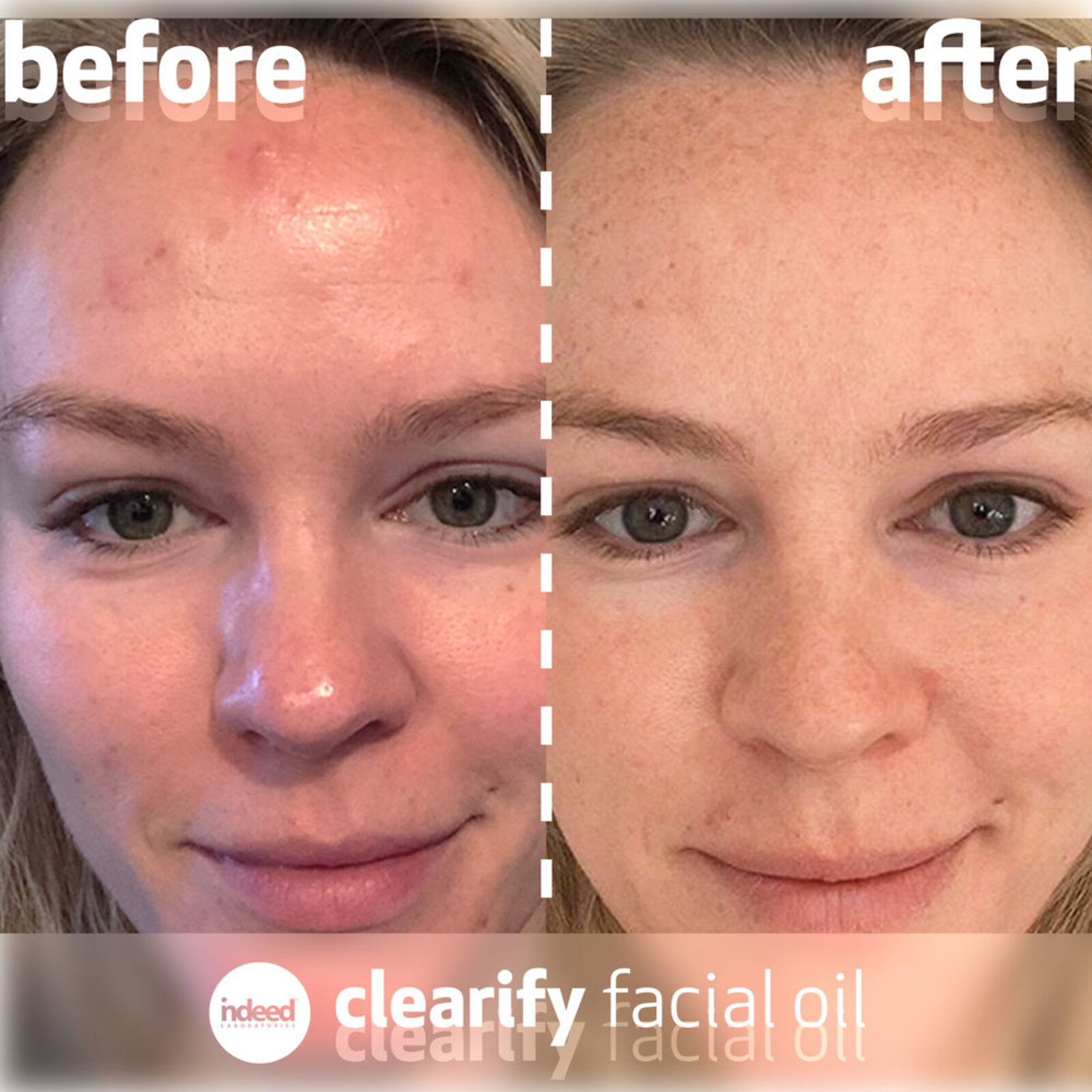 Indeed Labs Clearify Facial Oil