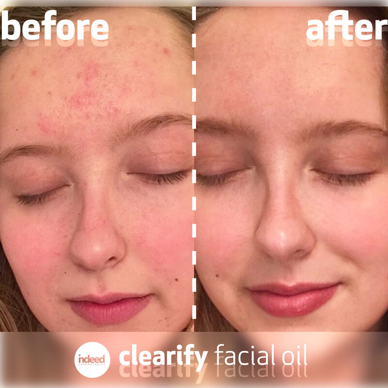 Clearify Facial Oil