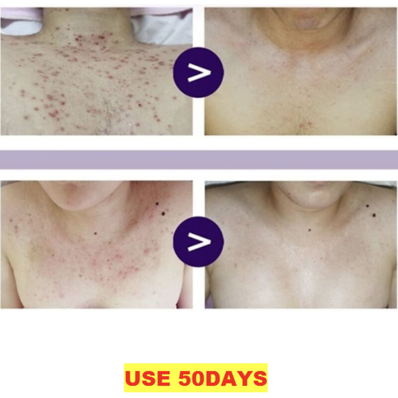 Green Pearlsation Tea Tree Care Body Spray