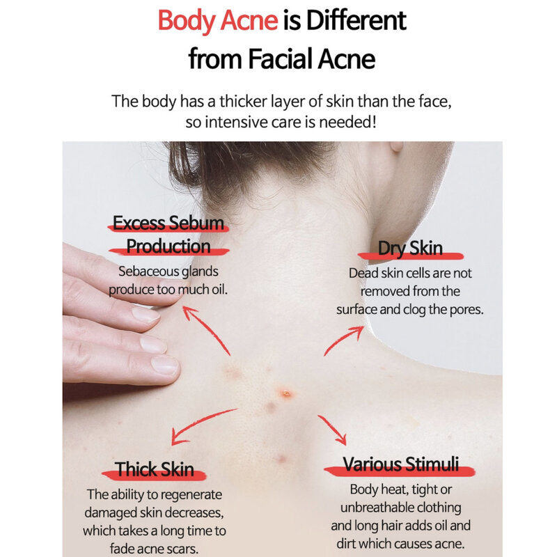 Anti-Blemish Body Lotion