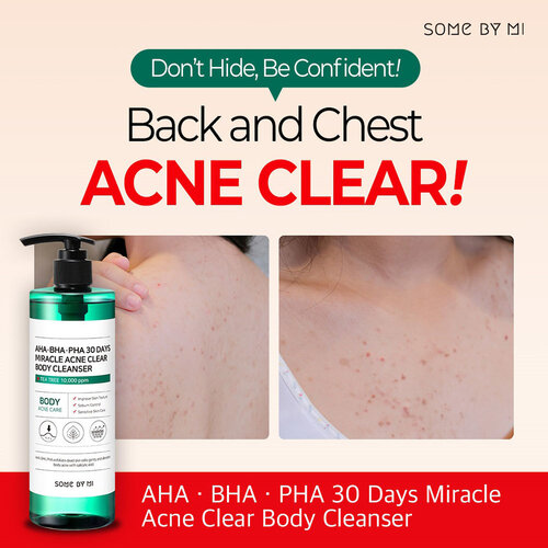 AHA.BHA.PHA 30 Days Miracle Acne Clear Body Cleanser Some By Mi AHA.BHA.PHA 30 Days Miracle Acne Clear Body Cleanser
