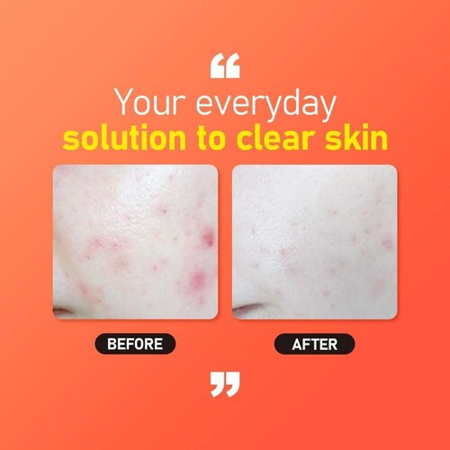 Jumiso All day Vitamin Brightening & Balancing Facial Serum