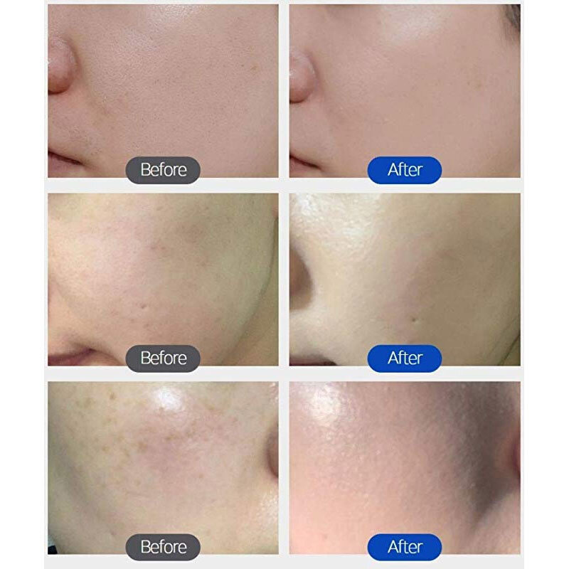 Aesthetic BB Cream H+ Formula