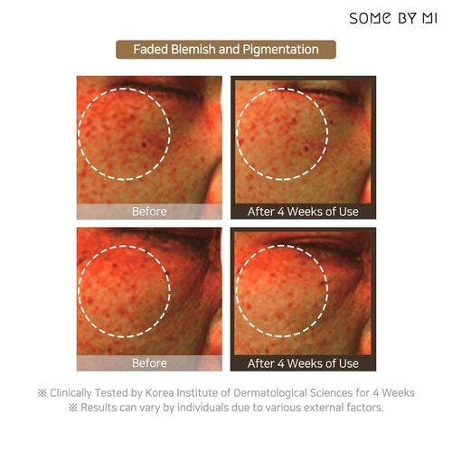 Galactomyces Pure Vitamin C Glow Serum Some By Mi Galactomyces Pure Vitamin C Glow Serum