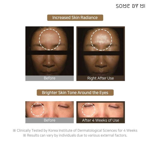Galactomyces Pure Vitamin C Glow Serum Some By Mi Galactomyces Pure Vitamin C Glow Serum