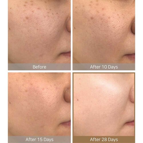 Galactomyces Pure Vitamin C Glow Toner Some By Mi Galactomyces Pure Vitamin C Glow Toner
