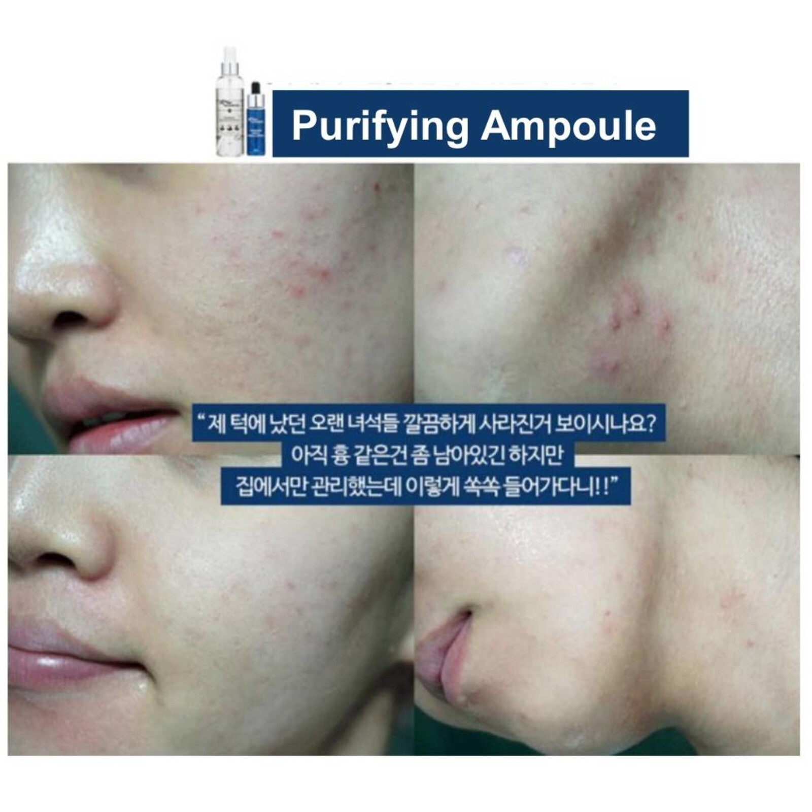 Troiareuke H+ Cocktail Purifying Ampoule