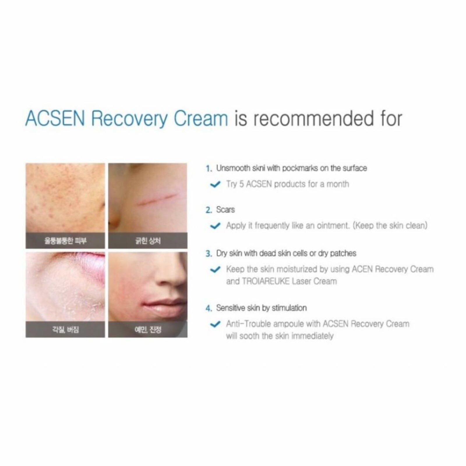 Troiareuke ACSEN Recovery