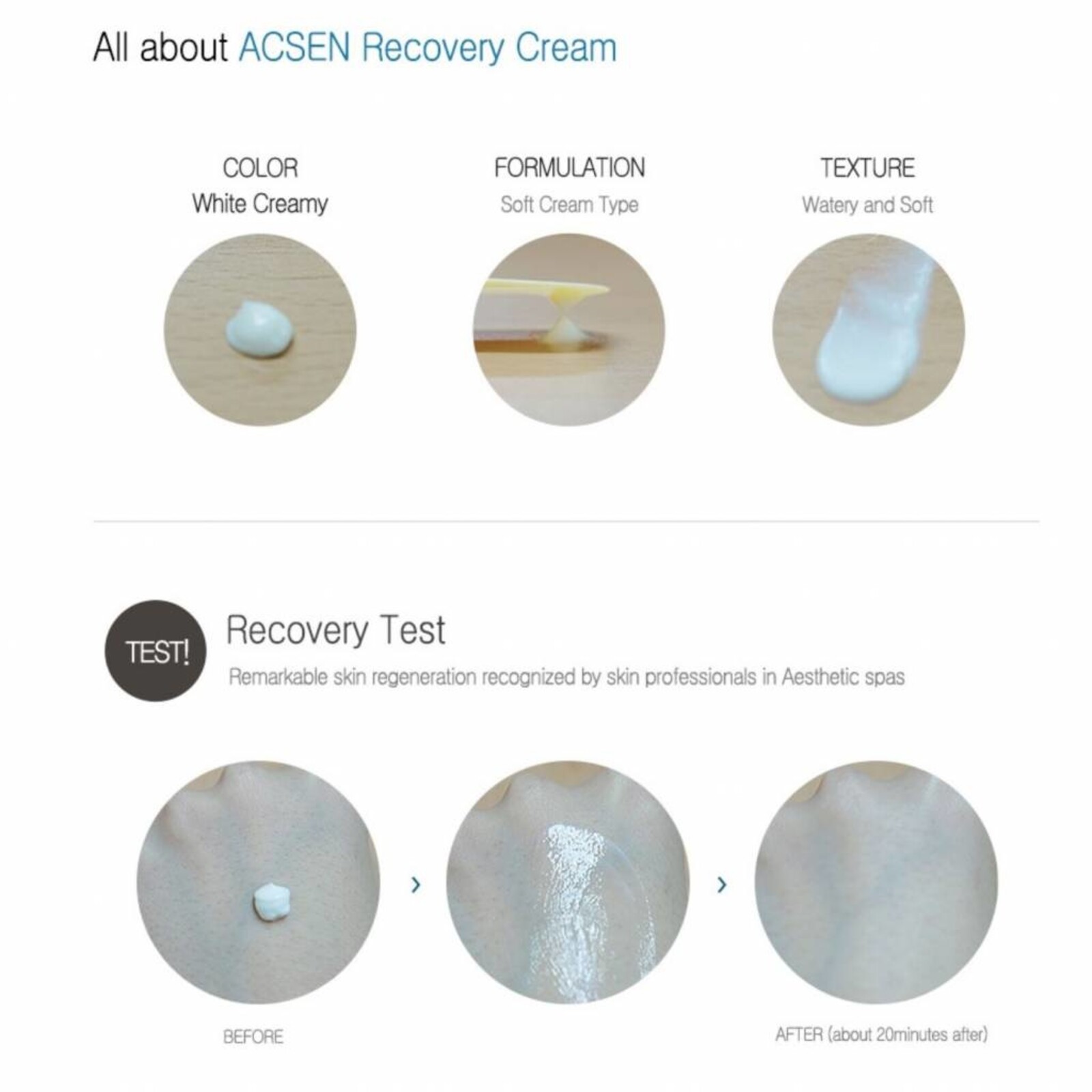 Troiareuke ACSEN Recovery