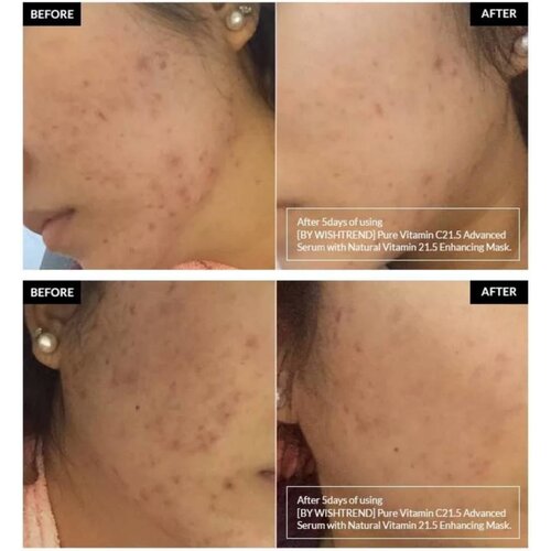 Pure Vitamin C 21.5% Advanced Serum By Wishtrend Pure Vitamin C 21.5% Advanced Serum