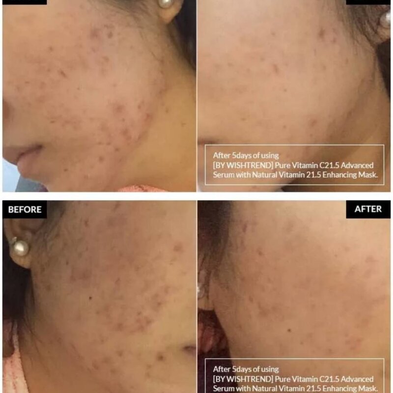 Pure Vitamin C 21.5% Advanced Serum