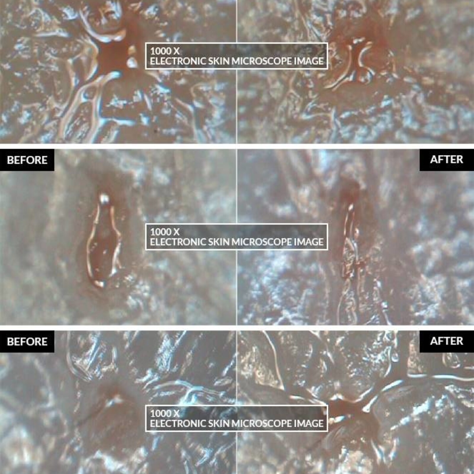 Skinmiso Pore Corset Serum