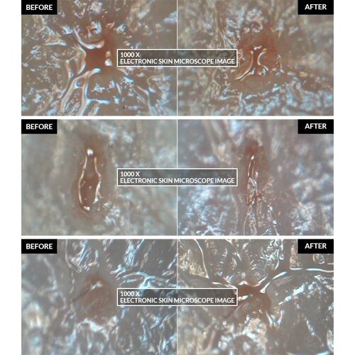 Pore Corset Serum Skinmiso Pore Corset Serum