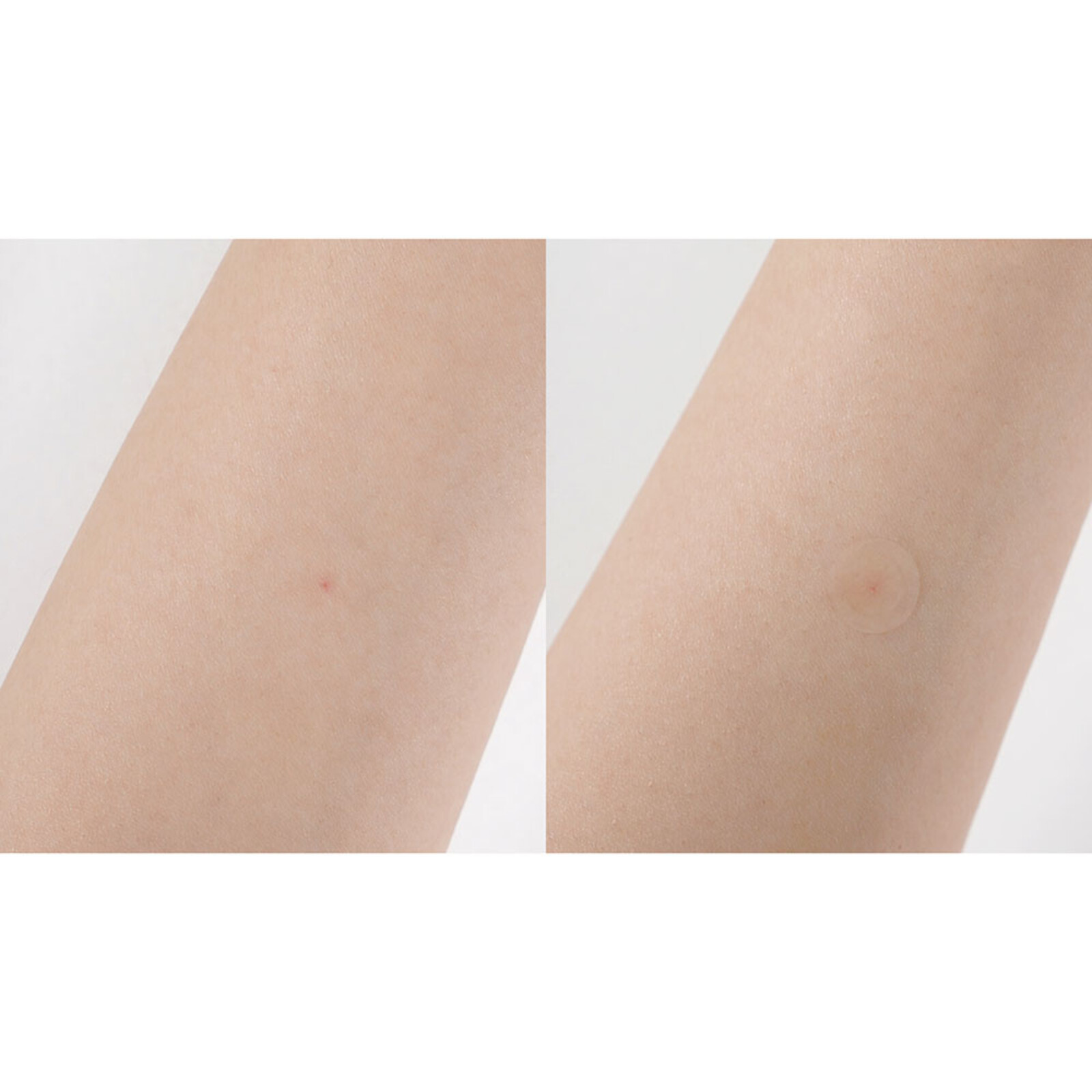 By Wishtrend Clear Skin Shield Patch