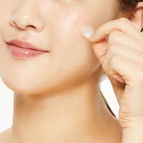 COSRX AC Collection Acne Patch