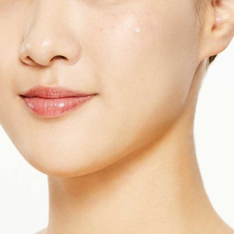 AC Collection Acne Patch