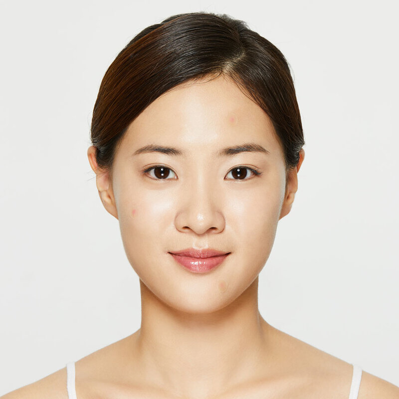 Acne Pimple Master Patch