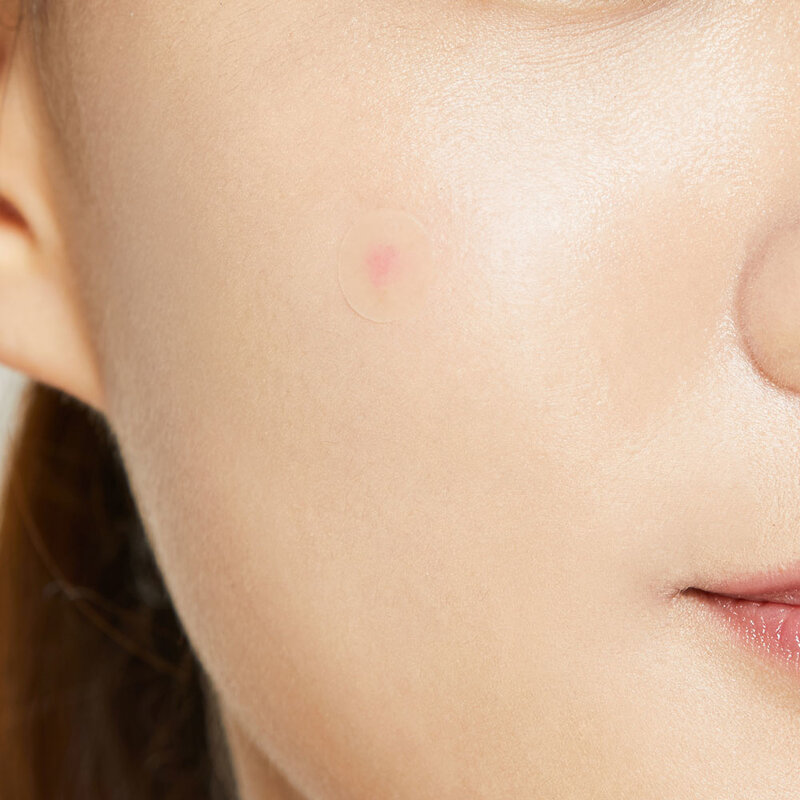 Acne Pimple Master Patch