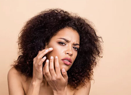 Skin Concern
