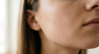 Zeg vaarwel tegen onzuiverheden: De beste oplossingen voor een zuivere huid