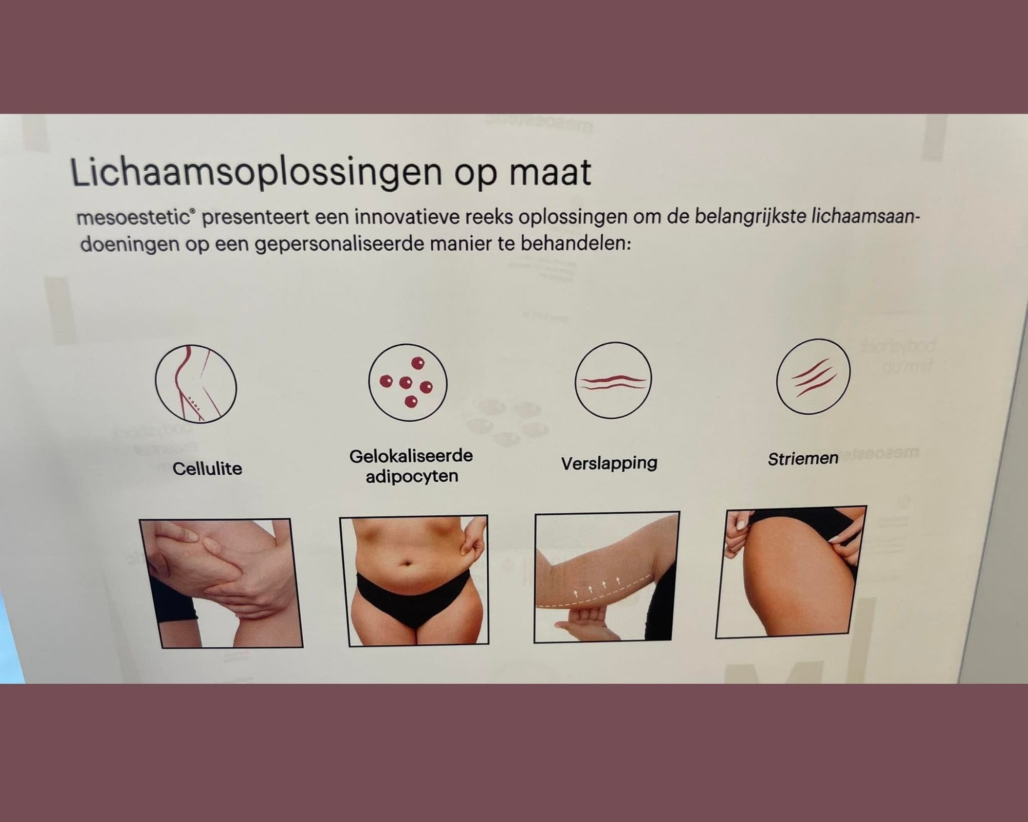 Huidverstrakking benen , armen, cellulite of plaatselijk buikvet verbranden?
