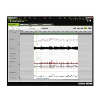 thumb-Prisma Soft - CPAP/PPC   - Löwenstein Medical (Weinmann)-4