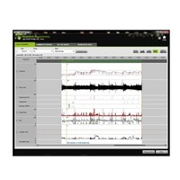 thumb-Prisma Smart – Selbstgesteuertes Auto-CPAP-Gerät – Löwenstein Medical-6