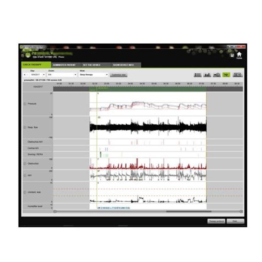 Prisma Smart – Selbstgesteuertes Auto-CPAP-Gerät – Löwenstein Medical-6