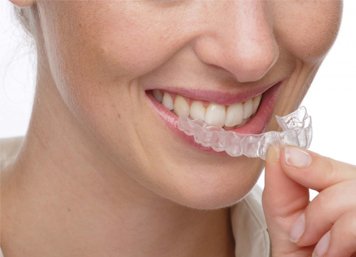 Protège-dents anti-grincement des dents - Prêt à l'emploi - Pas  d'ébullition ou de moulage - Mince, élégant et confortable - Fonctionne  pour la