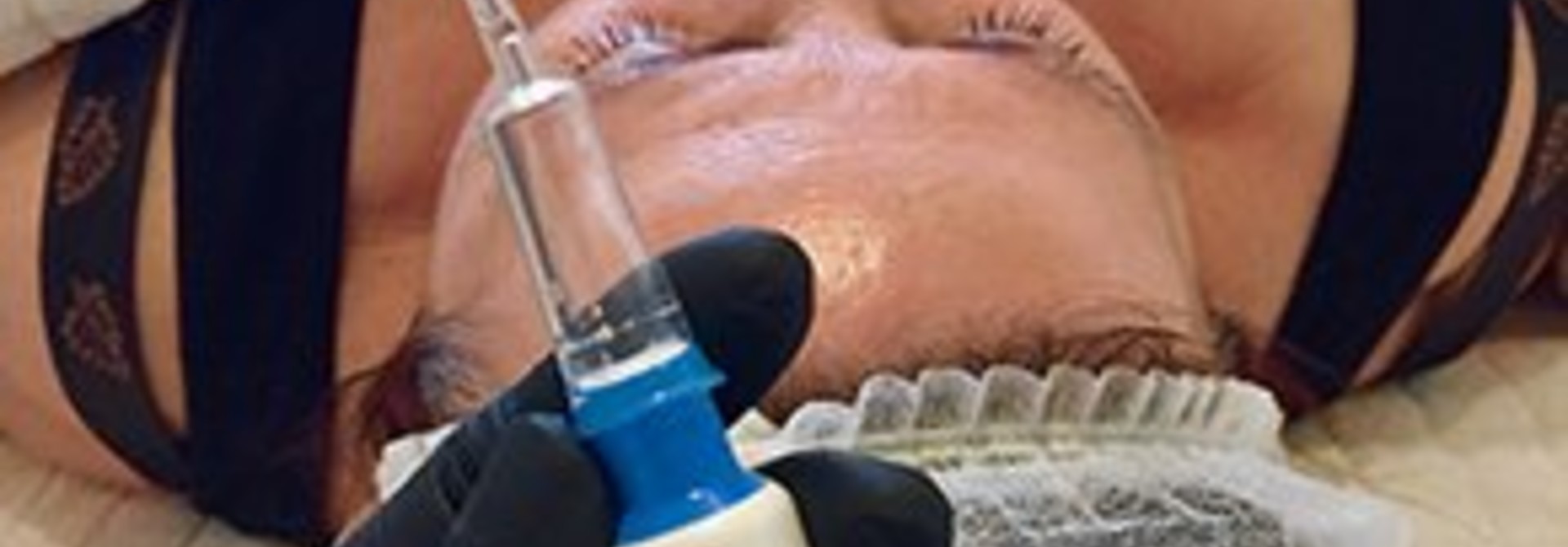 NIEUW @ SOULSOUP Skin Resurfacing Treatment