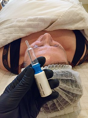 NIEUW @ SOULSOUP Skin Resurfacing Treatment