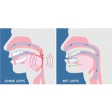 Snorflex tweedelige anti-snurkbeugel