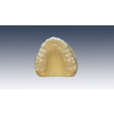 Knarsbitje op maat Slimline – 1.5 mm