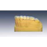 Knarsbitje op maat Slimline – 1.5 mm